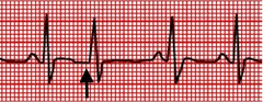 pulse