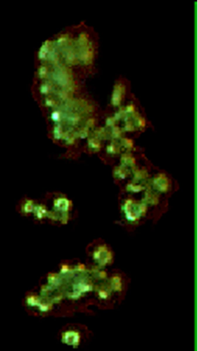 <p>spiral or ball shaped bacteria</p>