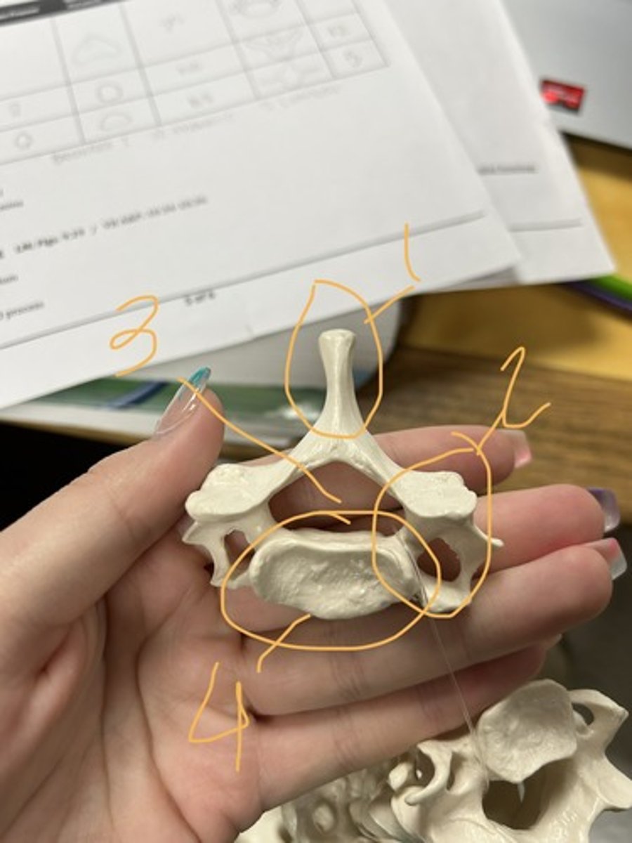 <p>type of vertebrae</p>