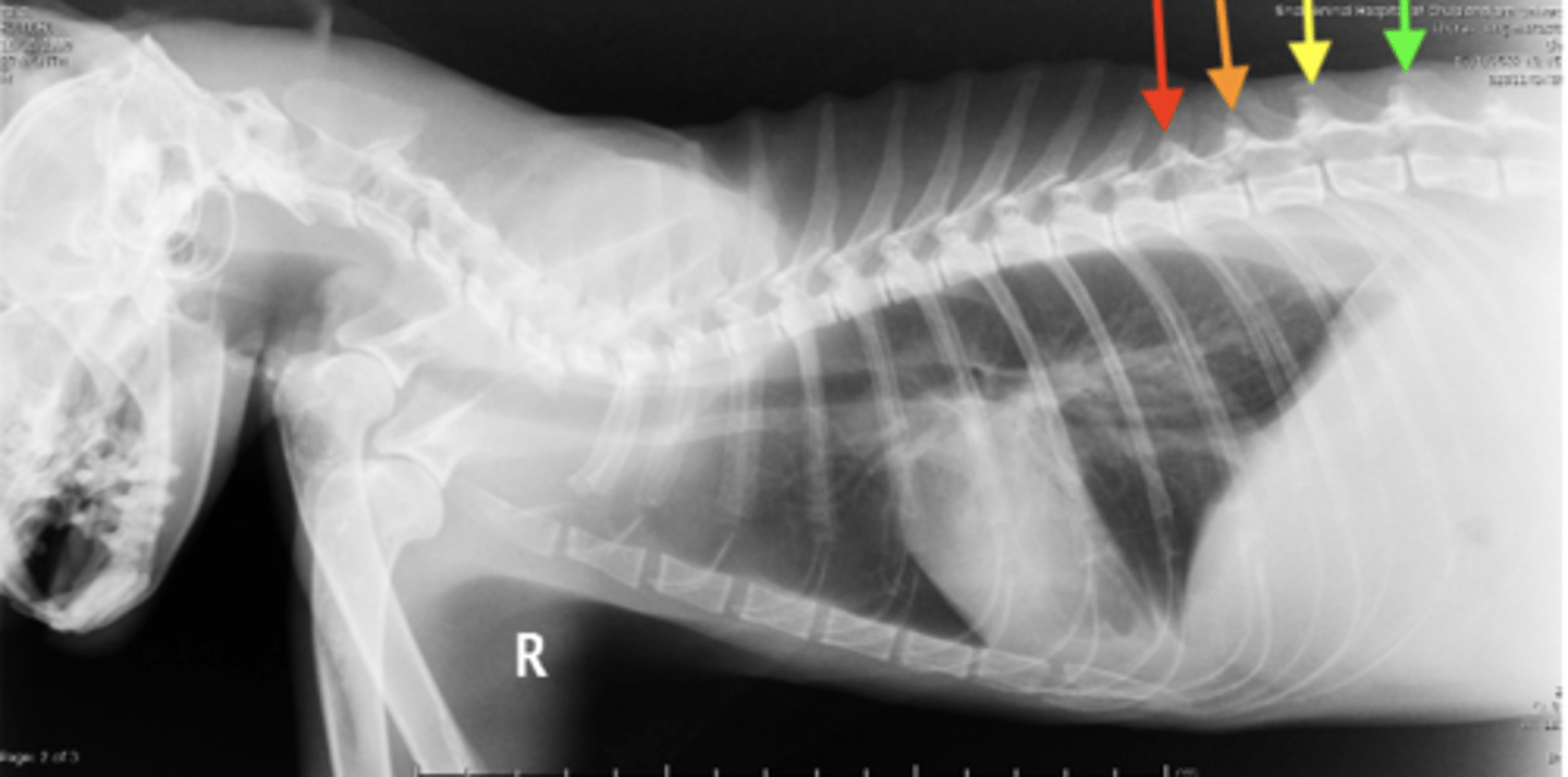 <p>Where on this radiograph is the anticlinal vertebra?</p>
