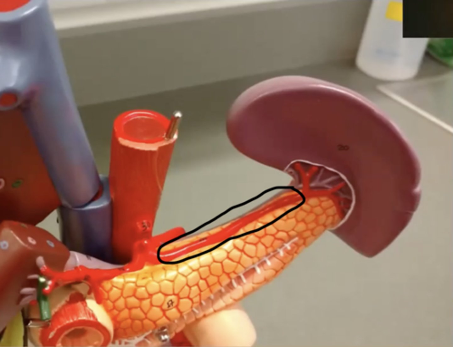 <p>Identify the vessel (include artery vs vein)</p>