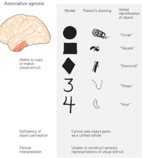 <p>Can copy or match visual stimuli but cannot see object parts as a unified whole</p><p>Unable to construct sensory representations of visual stimuli</p>