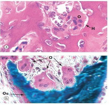 <ul><li><p>groot tot zeer groot</p></li><li><p>meerdere kernen (3-30 of meer) met prominente nucleoli &amp; acidofiel cytoplasma</p></li></ul><p>→ meerkernigheid komt door fusie van eenkernige voorlopercellen van osteoclasten</p>