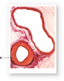 <p>Which type of blood vessel is labeled "B"?</p>