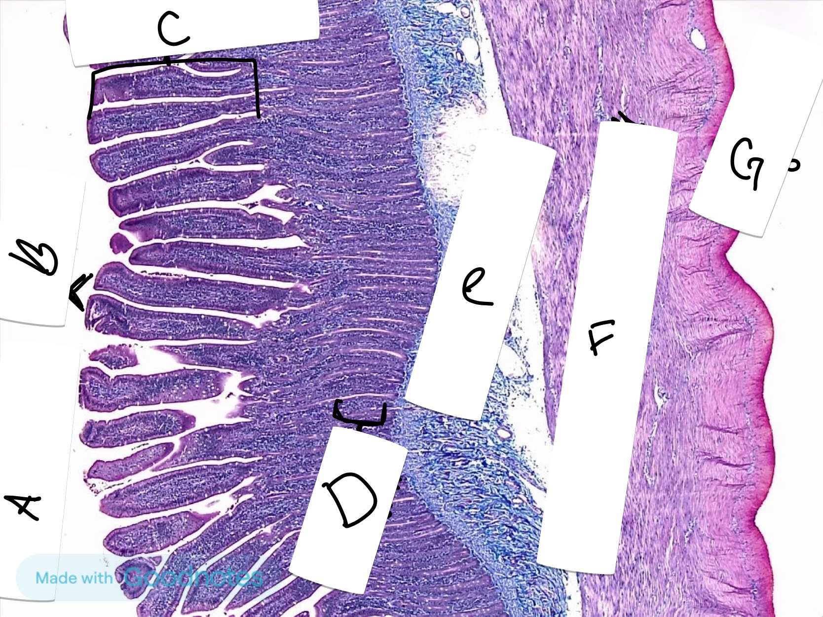<p>What is labeled F</p>