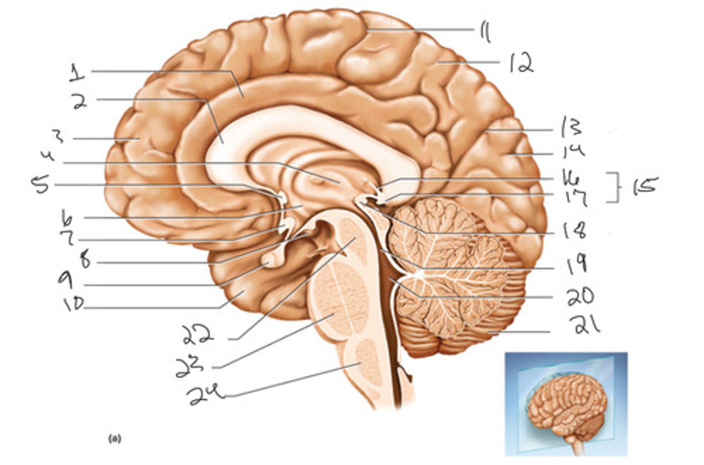 <p>What is number 2</p>