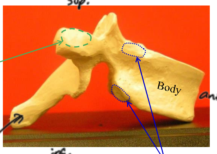<p>Name the group of vertebrae this one belongs to.</p>