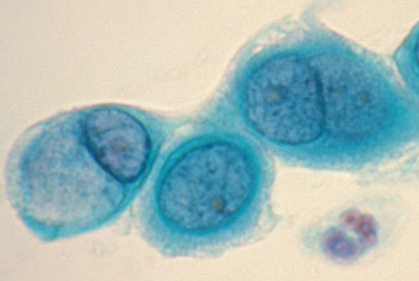 Gram negative, coccus morphology, obligate intracellular parasite of humans, cause *STD chlamydia*, cause *trachoma in eyes*