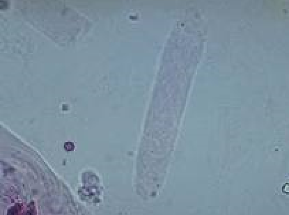 <p>What do you see in this image? Is it normal or abnormal?</p>