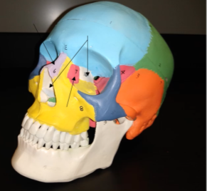 <p>What is this bone (pink region)</p>