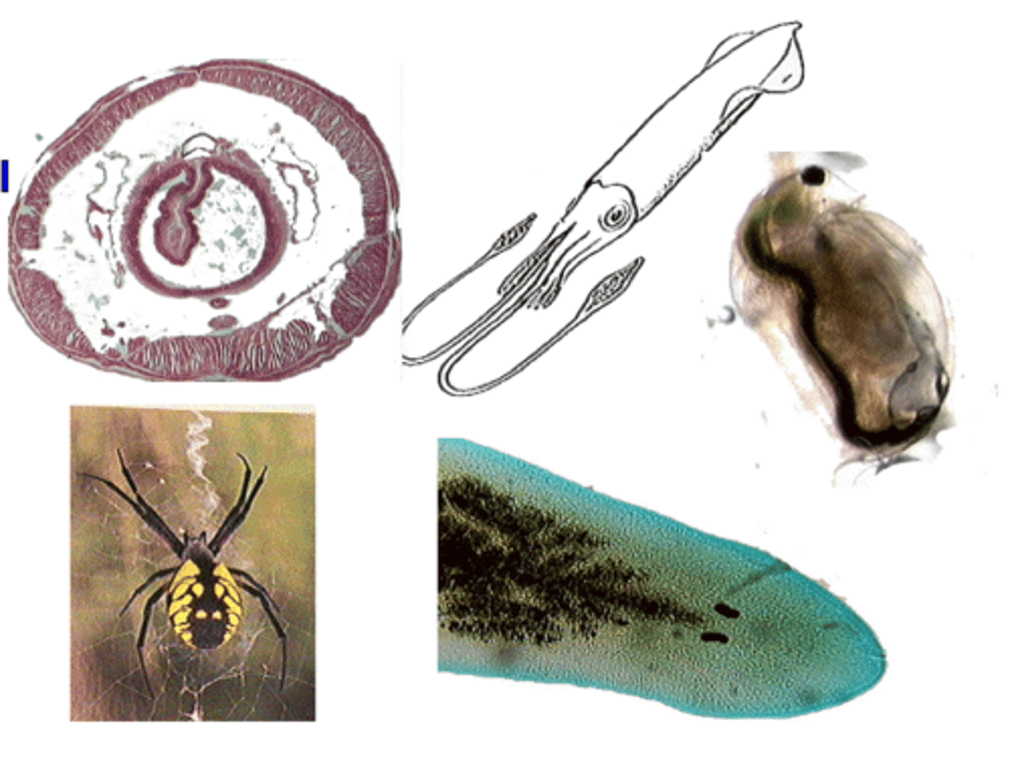 <p>Which of the following features is common to all of these organisms?</p><p>A) Segmented Body</p><p>B) Three Germinal Layers</p><p>C) Bilateral Symmetry</p><p>D) Presence of some type of Coelom</p><p>E) Two of the above</p>