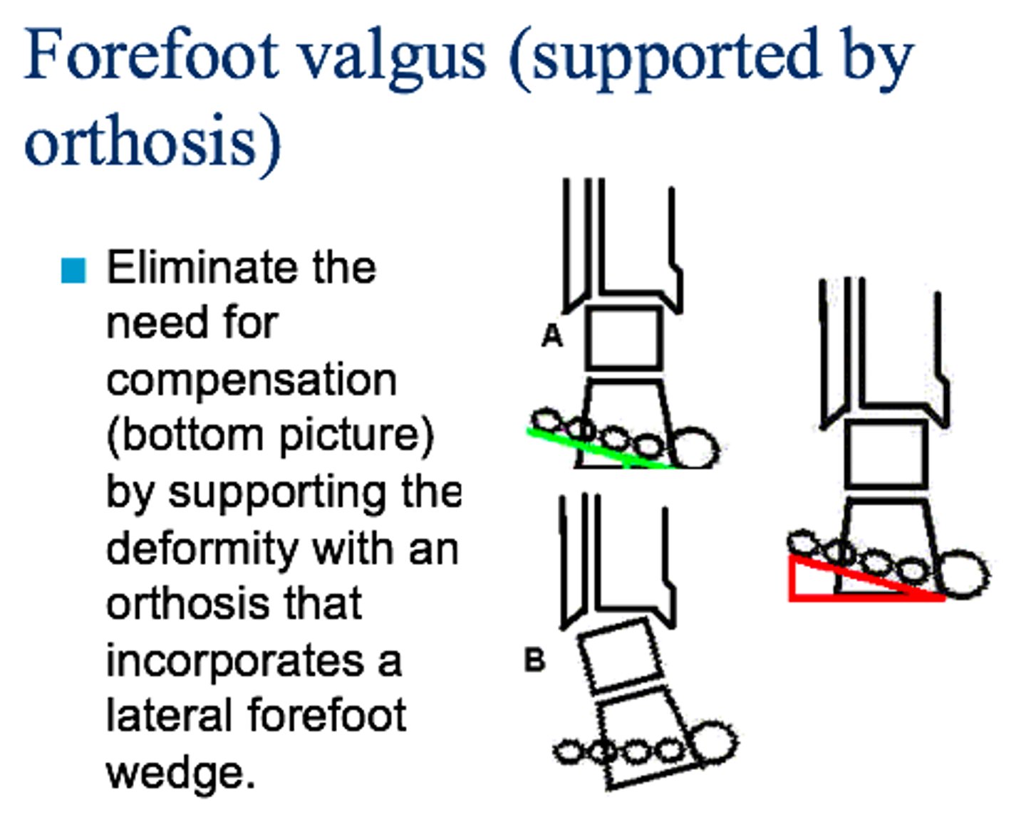 <p>For forefoot valgus</p>
