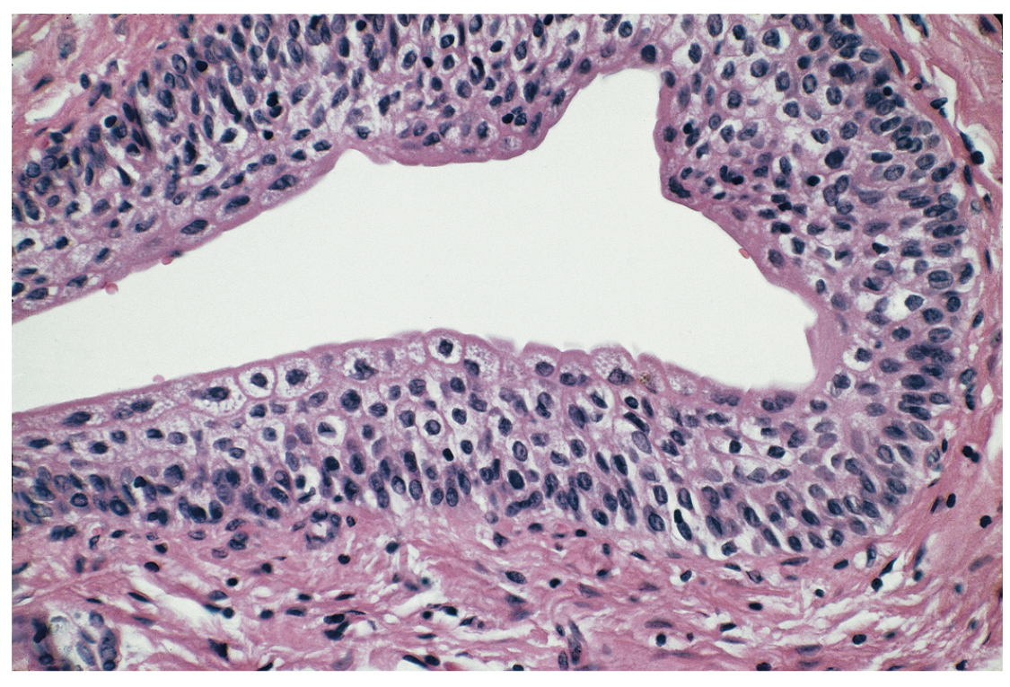 <p>Transitional epithelium.</p>