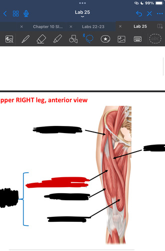 <p>What muscle is this?</p>
