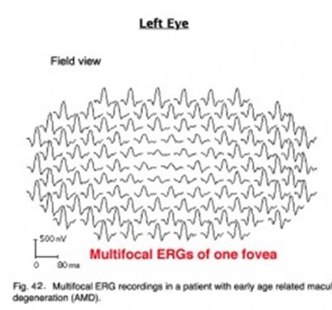 <p>assesses retinal activity in small areas of retina</p>