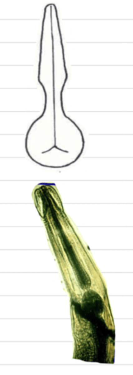 <p>what type of esophagus is this?</p>