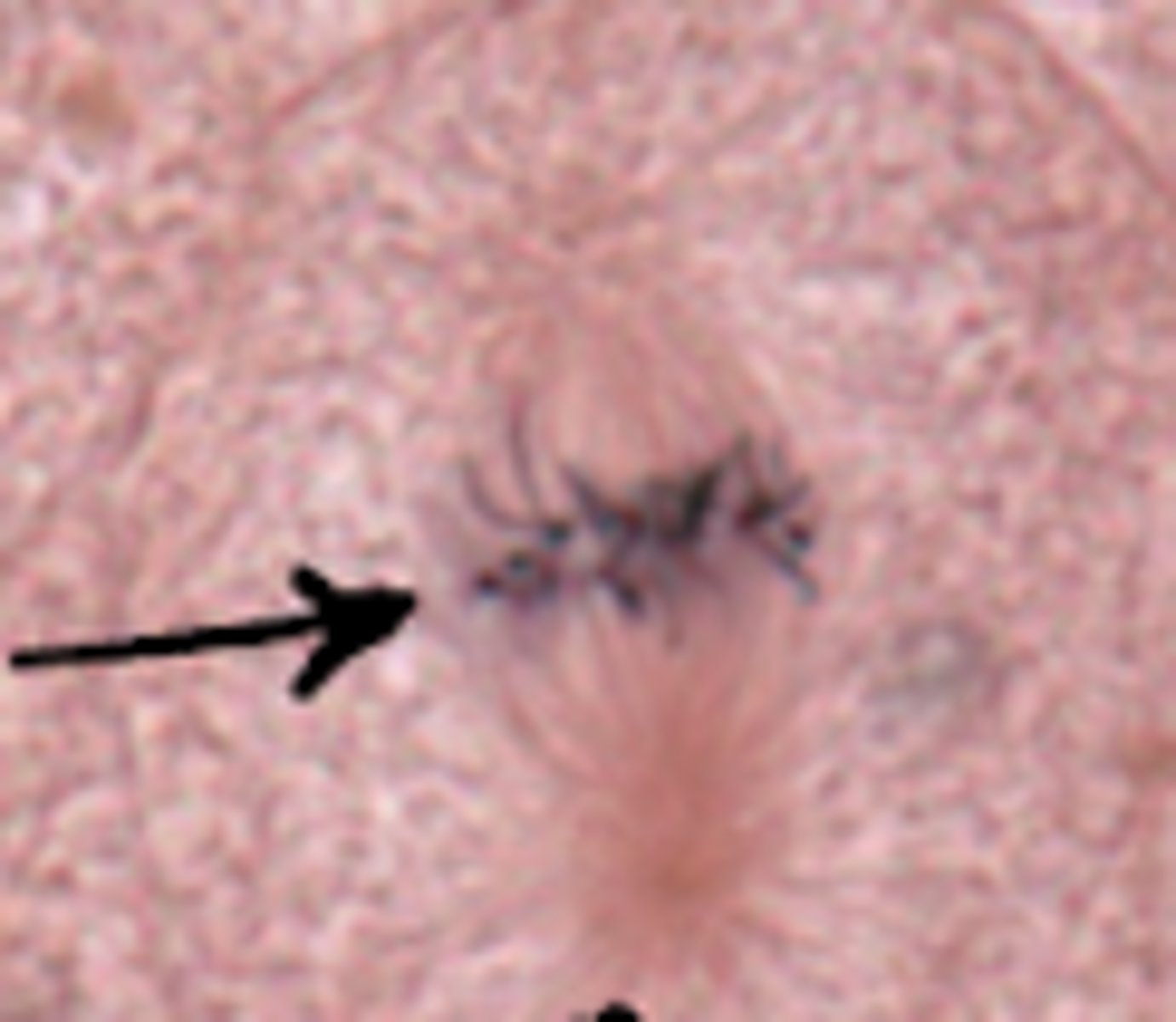 <p>what cell stage is shown</p>