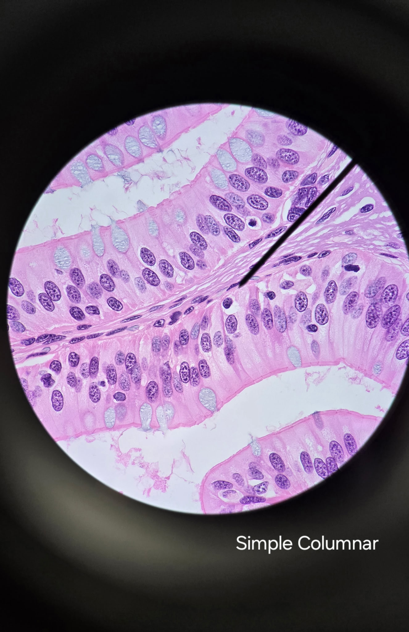 <p>Simple Columnar Epithelium</p>