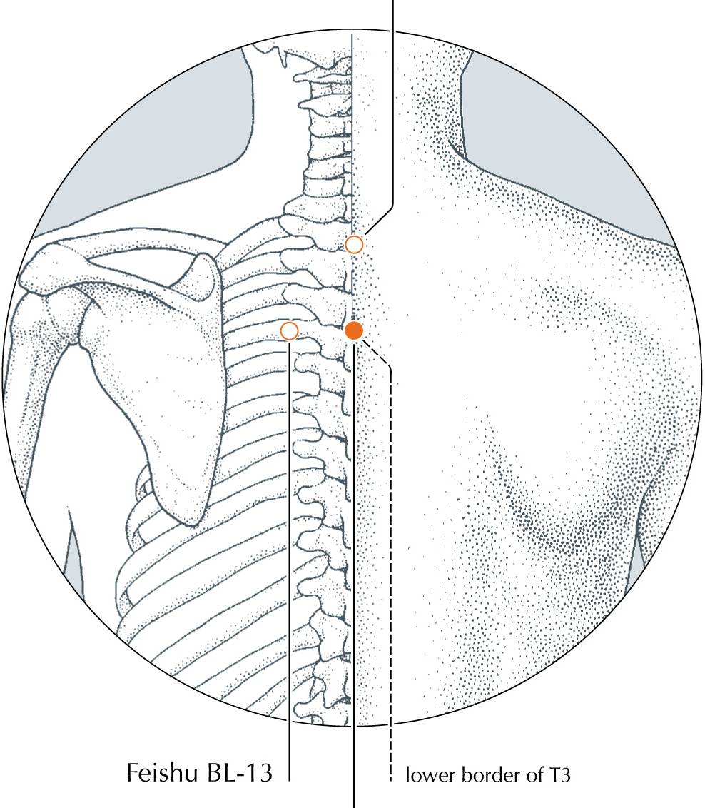 <p>DU-12</p>