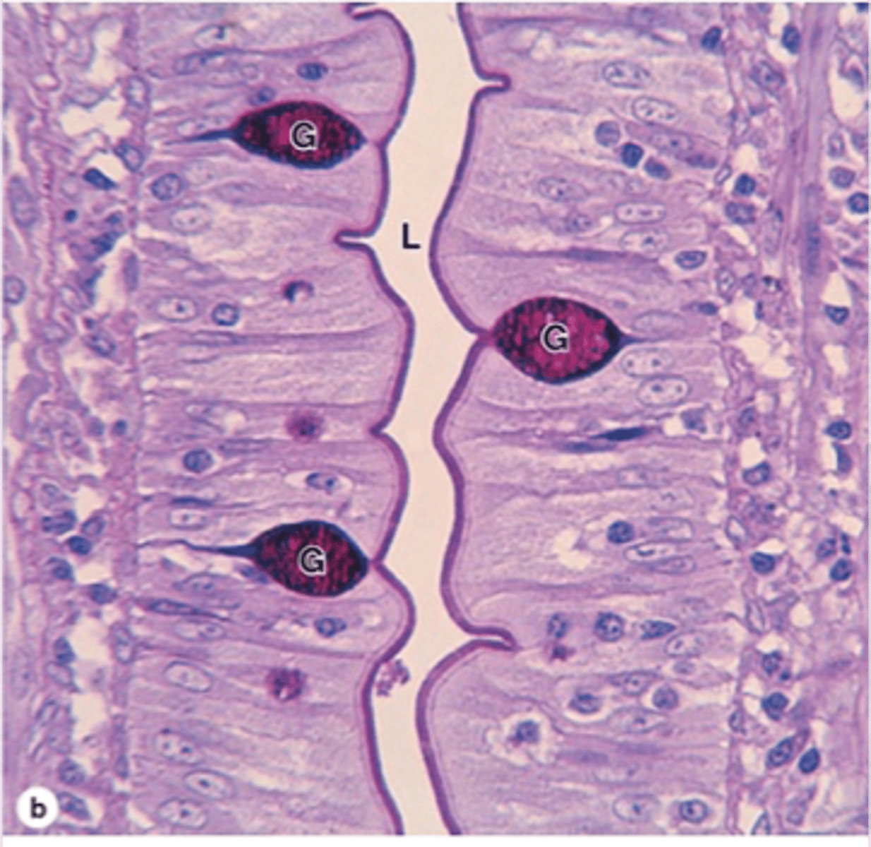 <p>Goblet cells: secretory granules rich in carbs are</p><p>PAS positive.</p>