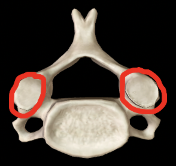 <p>Name this feature of the vertebrae</p>