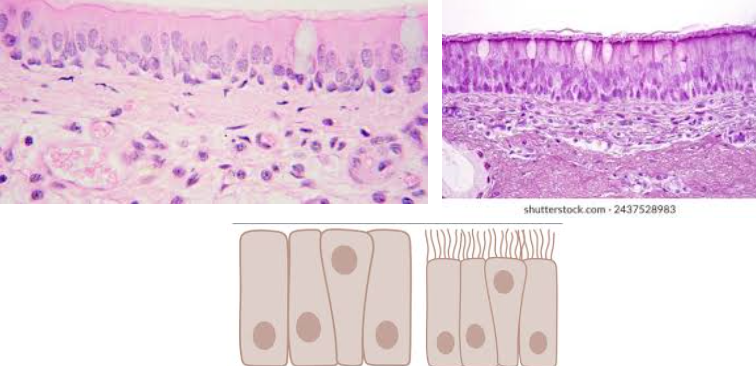 <ul><li><p>Characteristic:</p><ul><li><p><strong>SINGLE LAYER OF COLUMNAR CELLS,</strong> but their<strong> nuclei appear at different levels</strong></p><ul><li><p><strong>MAY CONTAIN SOME CILIA</strong></p></li></ul></li></ul></li><li><p>Location: <strong>TRACHEA</strong></p></li><li><p>Function: <strong>PROTECTION AND TRANSPORT MICROBES AWAY</strong> FROM LOWER RESPIRATORY TRACT</p></li><li><p></p></li></ul><p></p>