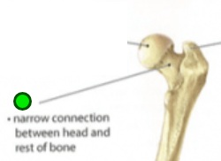 <p>Narrow connection between head and rest of bone</p>