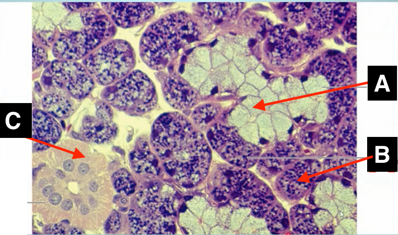 <p>identify A </p>