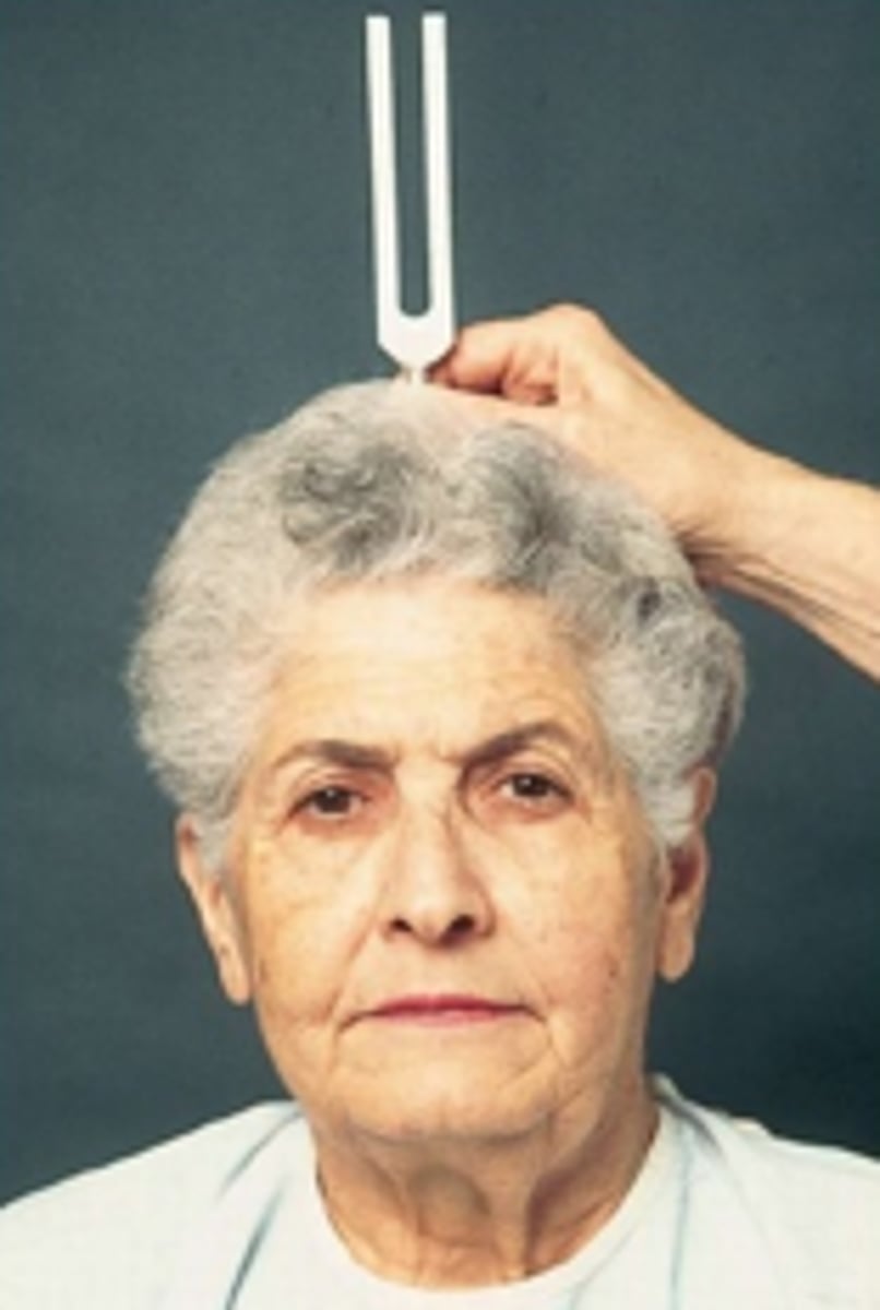 <p>In the ____ test, a vibrating tuning fork is placed at the vertex of the patient's head and the patient is asked if the sound is the same in both ears.</p>