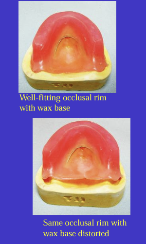 <p>an occlusal rim made in wax (and a wire strengthner) can easily distort - </p><p>either the rims don’t seat properly in the mouth or they don’t seat properly on the casts when you try to articulate them </p><p>using heat-cured bases is only possible in <strong>edentulous </strong>arches but ensures no base distortion and also means the rims fit well in the mouth which helps accuracy when recording jaw relationships </p>