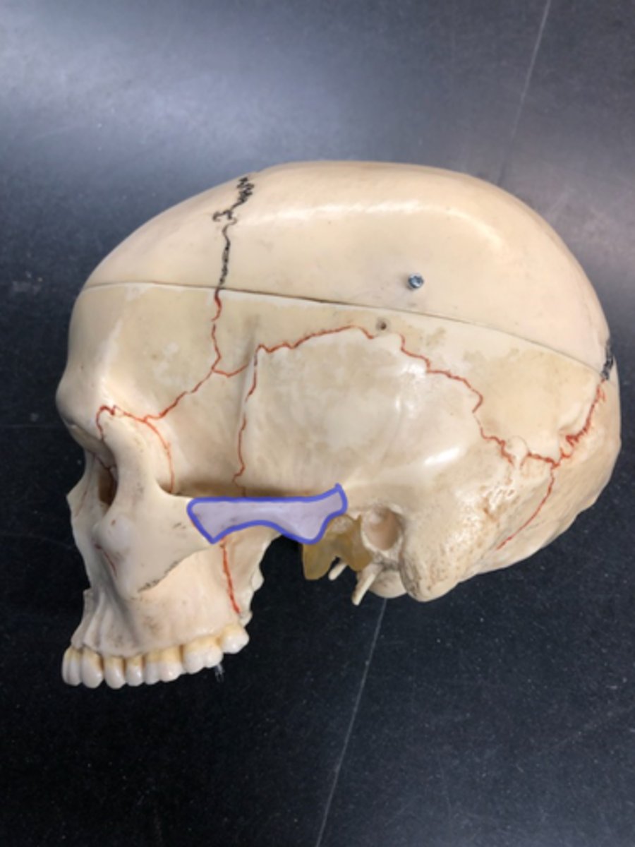 <p>Left half of zygomatic arch; before the suture</p>