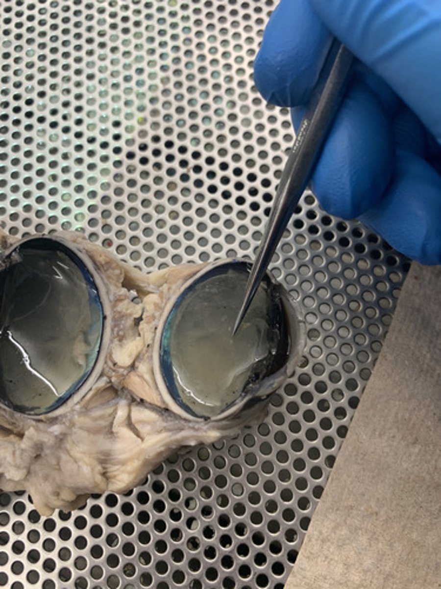 <p>jellylike substance found behind the lens in the posterior cavity of the eye that maintains its shape</p>