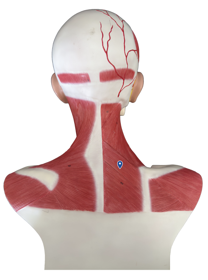 <p>What muscle is the arrow pointing to?</p>