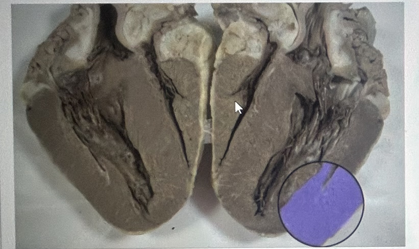 Identify the highlighted sheep heart structure (frontal section) 