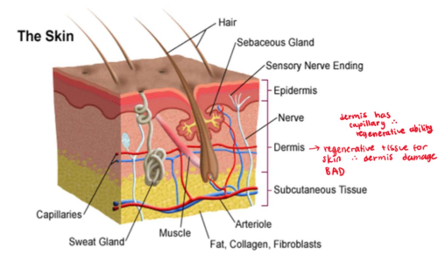 <p>- associated with: flames, hot liquids, hot solid objects, steam</p><p>- not usually uniform in depth, many have a mixture of deep and superficial components</p><p>- burn wounds are dynamic => can progress to deeper wounds (may require several days for a final classification)</p><p>- regeneration is dependent on presence of dermal tissue, no dermal tissue means grafting is needed</p>