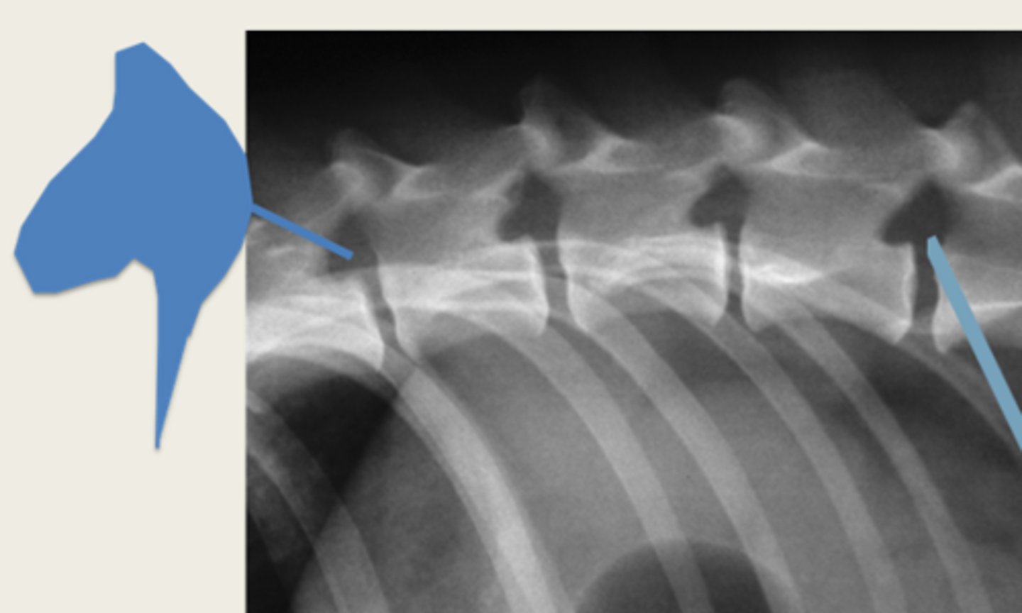 <p>Lumbar region; horse heads</p>