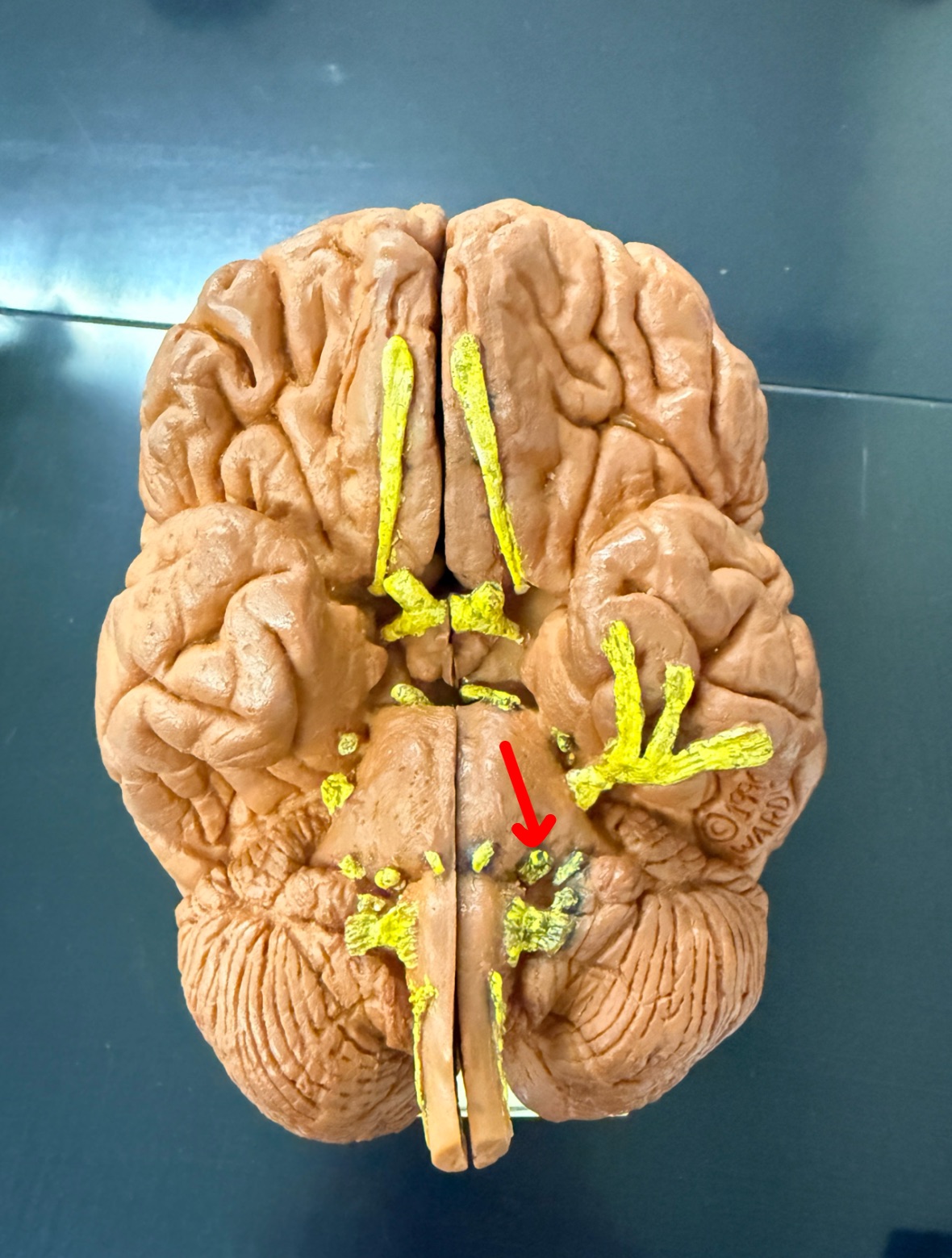 <p>Name the cranial nerve on the brain model</p>