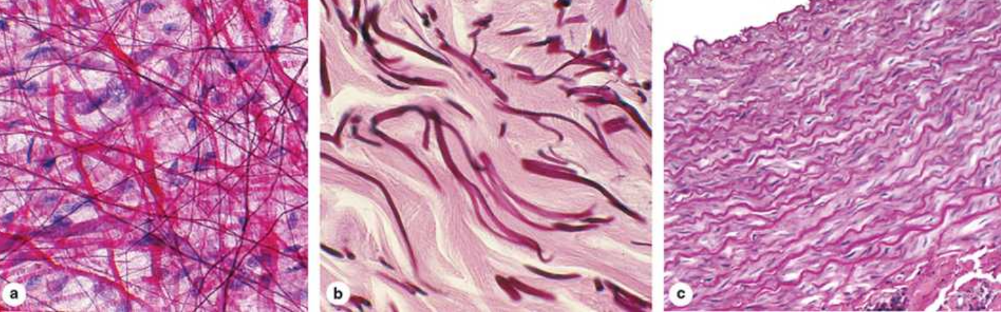 <p>Elastic fibers</p>