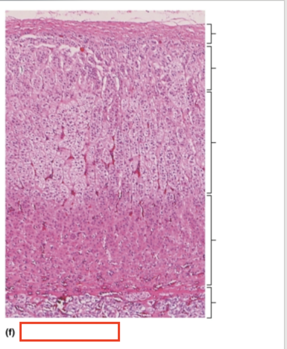 <p>What tissue is shown? </p>