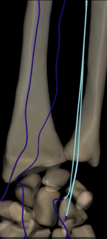 <p>What is highlighted in blue?</p>