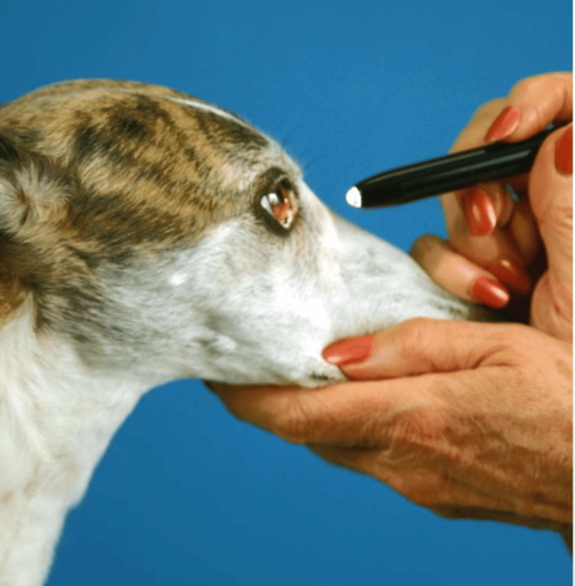 <p>what is this test for?</p>