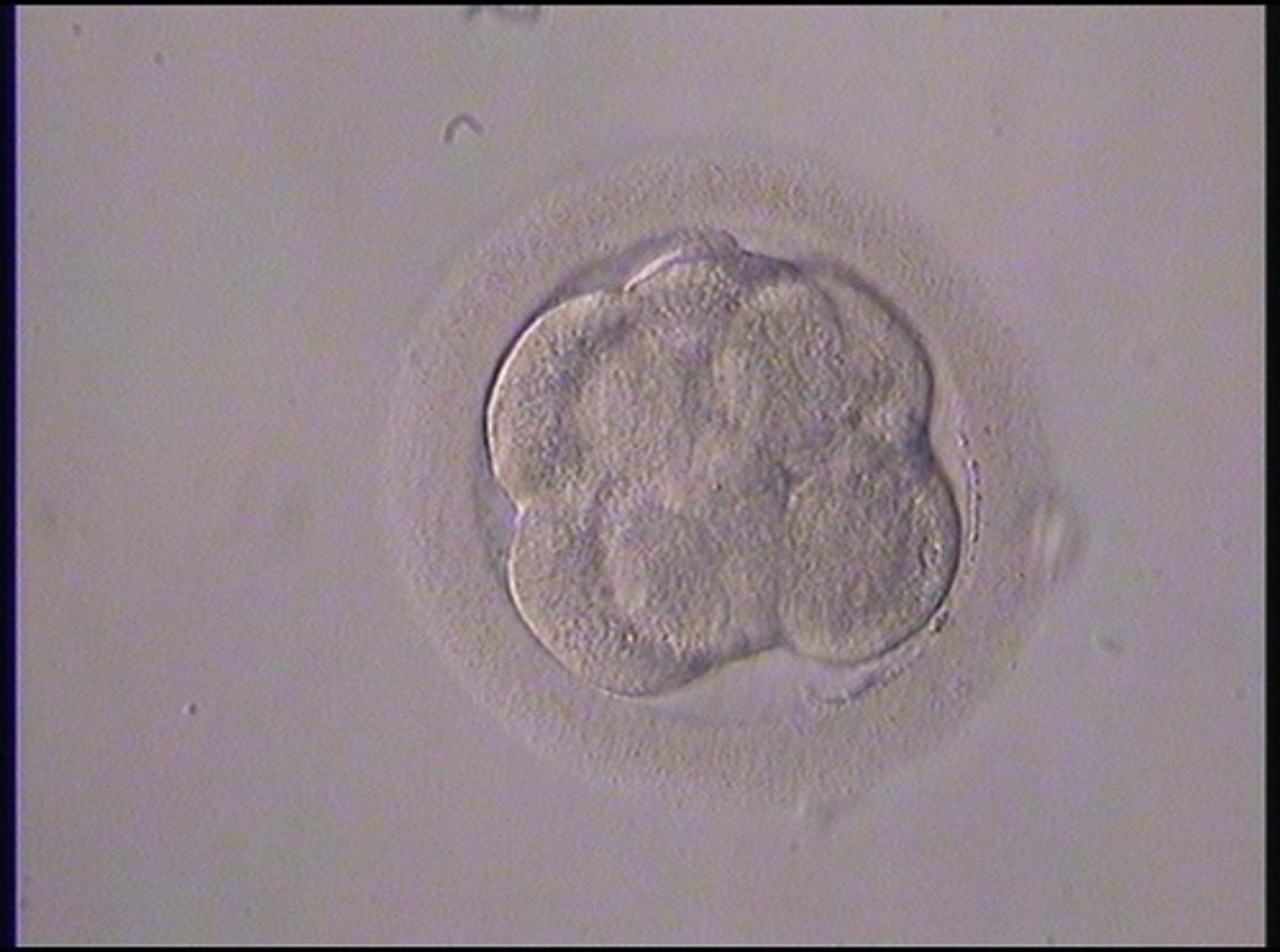 <p>identify the stage of fertilization:</p>