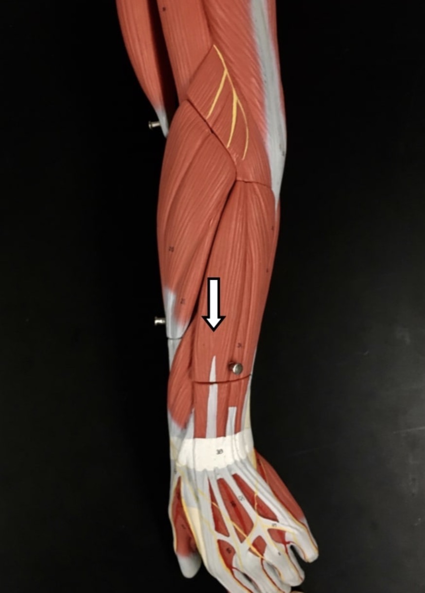 <p><span>Name the muscle labeled with the white arrow below AND name the origin</span></p>