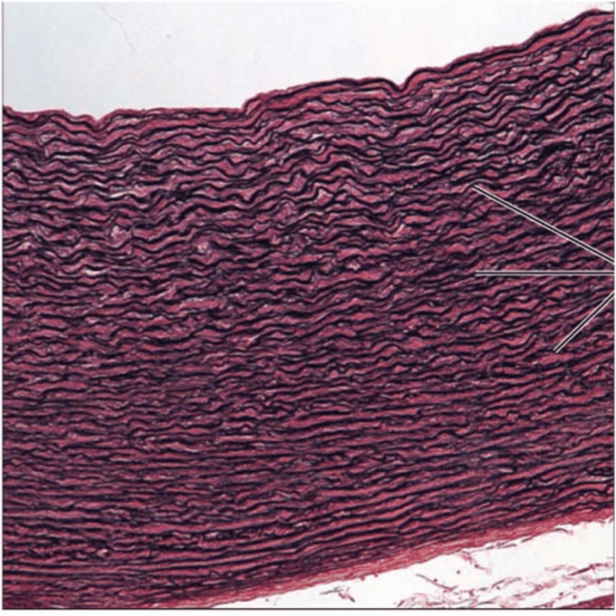 <p>Fibroblasts and fibrocytes</p><p>Fibers made of collagen and elastic fibers - made up of elastin or titin protein</p><p>Location: lining of large blood vessels, vocal cords, suspensory ligament of penis, some ligaments of spinal column</p><p>Appearance: dark, squiggly lines</p><p>Allow for stretch and stretch back</p>