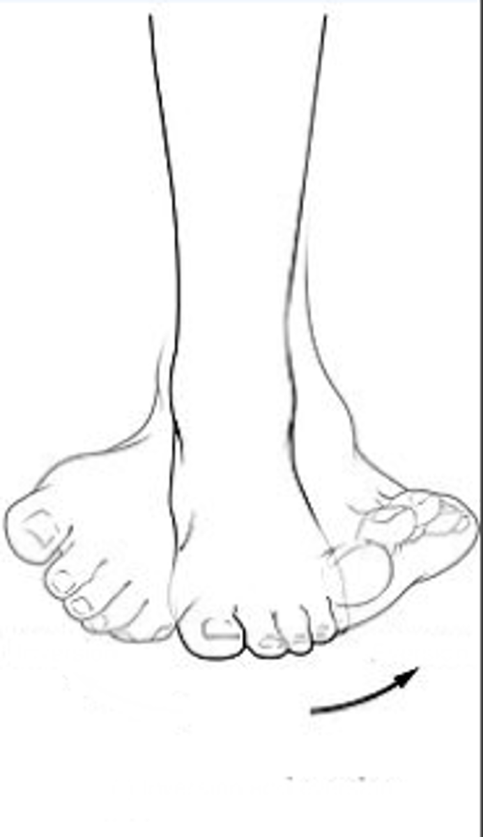 <p>Identify the action indicated by the arrow.</p>