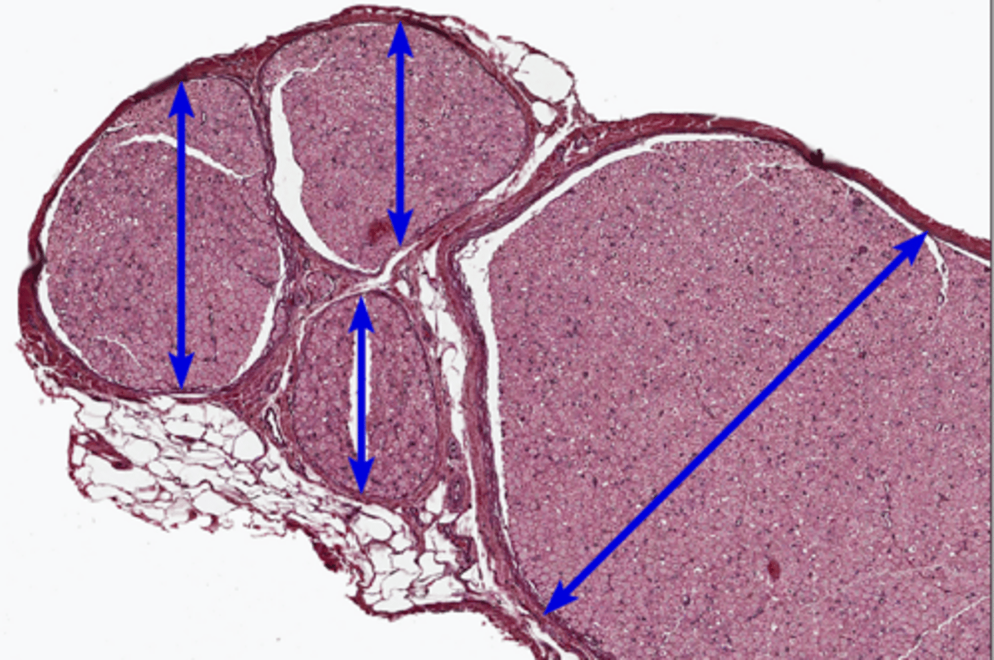 <p>bundles of muscle fibers wrapped around each other</p>