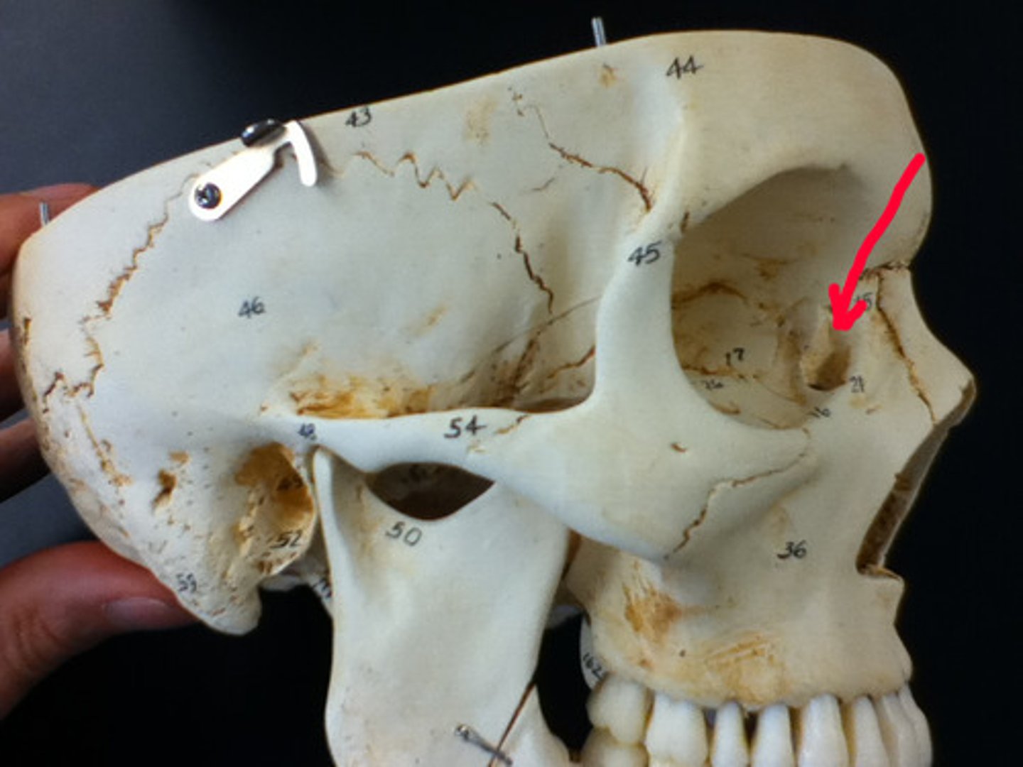 <p>Anterior and lateral depression of roof of orbit which accommodates the lacrimal gland</p>