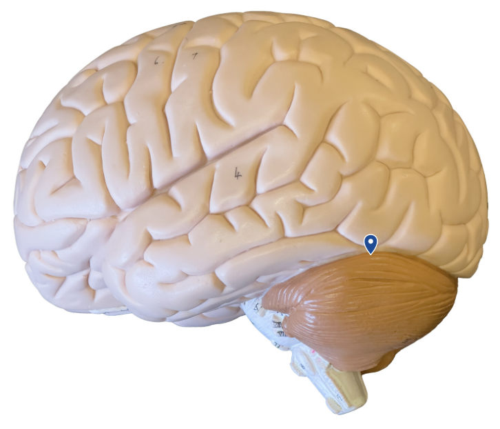 <p>What sulcus is the arrow pointing to?</p>