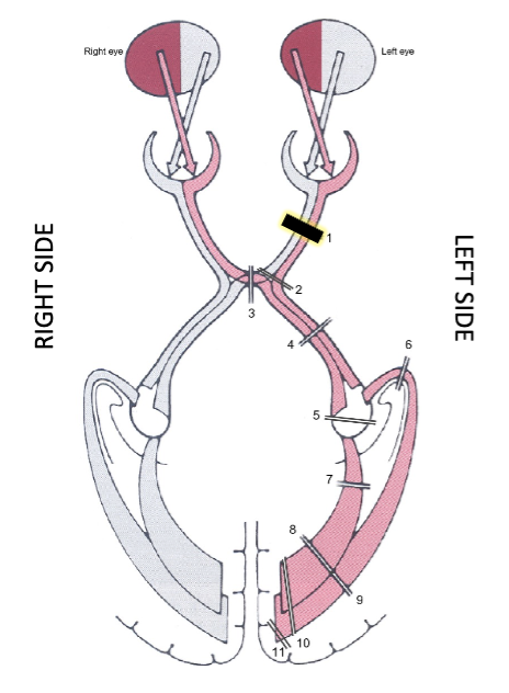 term image