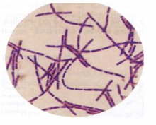 <p>What Bacterial Arrangement?</p>